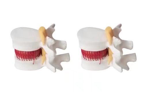 BoNew 1:1.5 Anatomical Human Lumbar Vertebrae Degenerative Lumbar Human Spine Model White Color