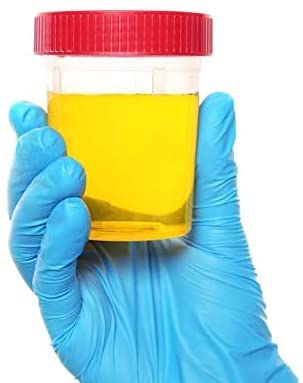 [Australia - AusPower] - SUMEDTEC 10 Pack (120ml) Sterile Urine Analysis Containers with Airtight Lid and Name Tag 