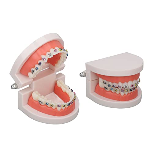 Orthodontic Dental Model, Typodonts Orthodontic Demonstration Model with Metal Wires and Bracket Teaching, Learning, Interpretation Model for Adults and Children