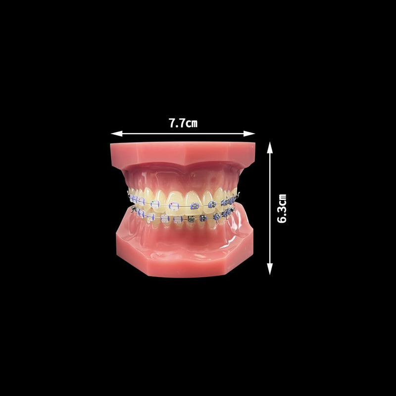 Orthodontic Tooth Model with Brackets, YOUYA DENTAL Demonstration Orthodontic Model for Education, Teeth Demonstration Typodonte Anatomical Teaching Tool with Metal and Ceramic Holder