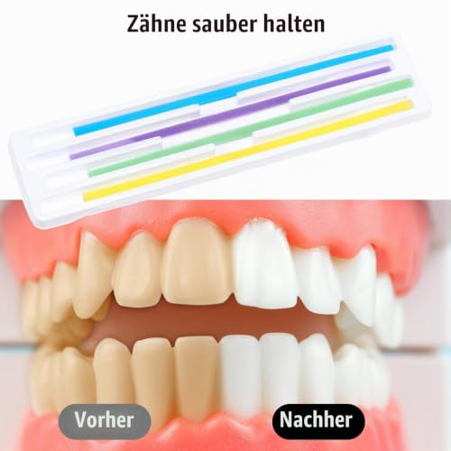 60 Pieces Teeth Sandpaper Tooth Polishing Strips Dental Sanding Strips | For gaps, dental sandpaper, oral care, teeth finishing gloss, contouring tool, for deep cleaning of teeth 60