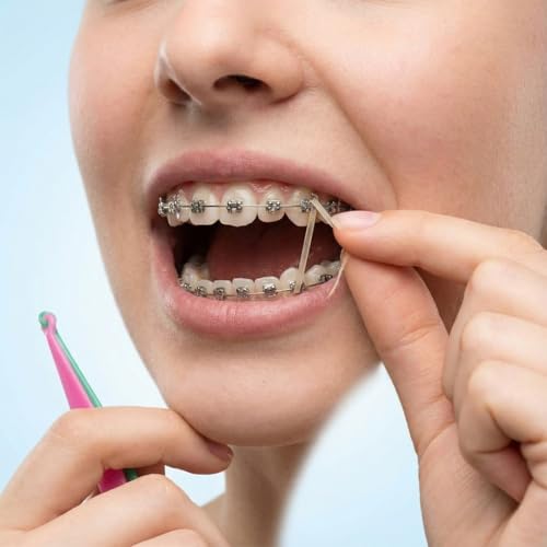 600 Pcs Elastic Brace Bands Set for Braces, Gaps and Misalignments with 6 Aligners (3/16", 1/4")