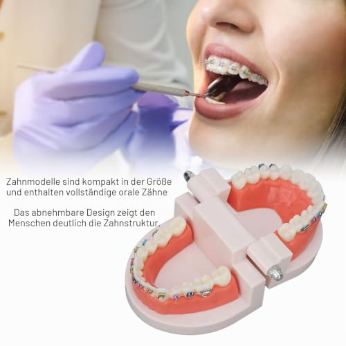 Orthodontic Dental Model, Typodonts Orthodontic Demonstration Model with Metal Wires and Bracket Teaching, Learning, Interpretation Model for Adults and Children