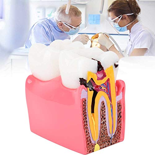 Dental Anatomy Model Resin Dental Lab Oral Care Model