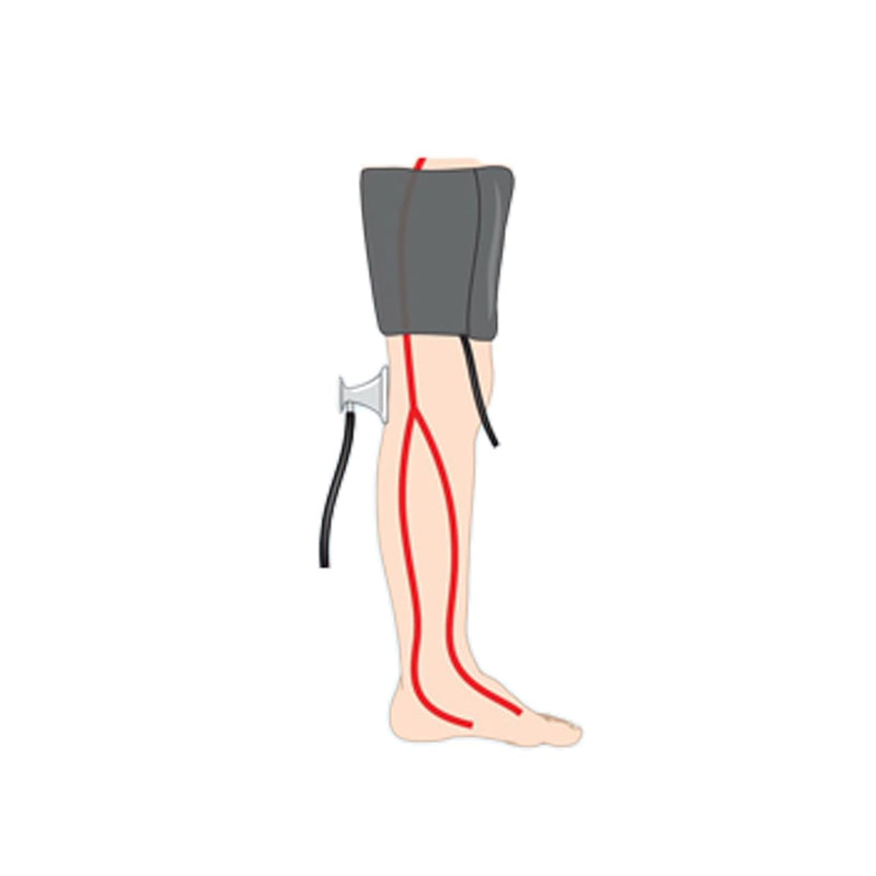 [Australia - AusPower] - EMI Thigh Sized Manual Blood Pressure Monitor Set Cuff Size (16 to 25 inch) (Thigh Bp Cuff Only) Thigh Bp (Cuff Only) 
