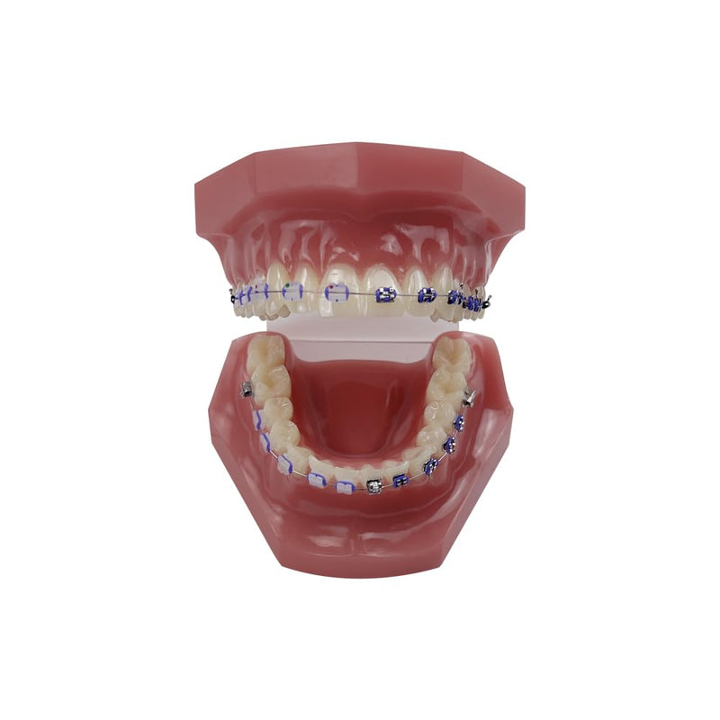 Orthodontic Tooth Model with Brackets, YOUYA DENTAL Demonstration Orthodontic Model for Education, Teeth Demonstration Typodonte Anatomical Teaching Tool with Metal and Ceramic Holder