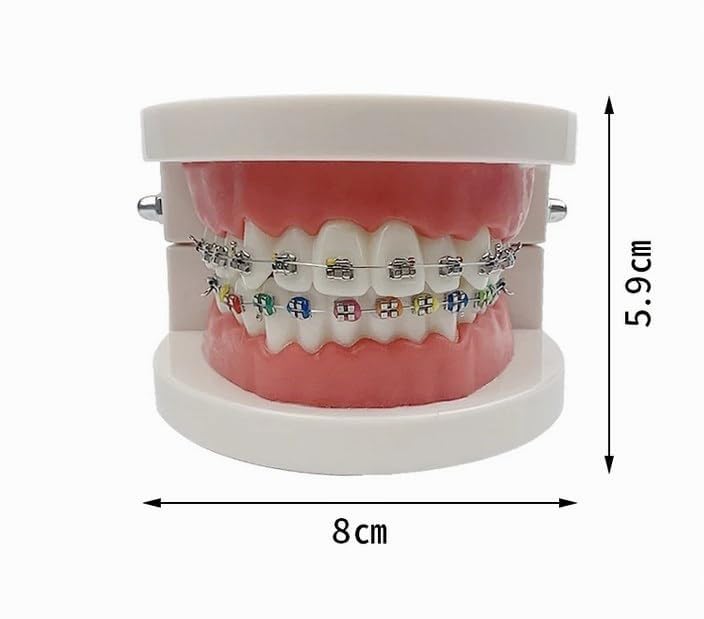 Tooth Demonstration Model, Teeth Dental Demonstration Model, Dental Typodont Teeth Model with Orthodontic Metal Clamp for Dentist Teaching Research Dental