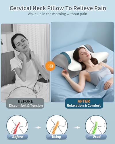 Cervical Pillow for Neck Pain Relief - Ergonomic Neck Pillow for Sleeping in Bed, Contour Memory Foam Pillows Side Sleeper Pillow for Neck Support, Bed Pillows for Back Stomach Sleepers,(LightWhite)