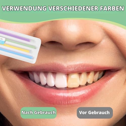 Pack of 60 dental sanding paper polishing strips, teeth cleaning | Spaces 18 x 4.5 x 0.7 mm tooth sandpaper interdental grinding tools for polishing teeth