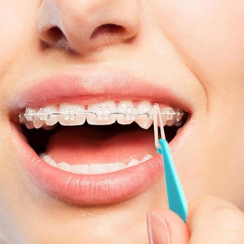 Pack of 10 Orthodontic Elastic Disposable Plastic Braces, Colorful Disposable Plastic Hooks for Orthodontics, Elastic Rope Hook, for Braces Dental Gaps Crooked