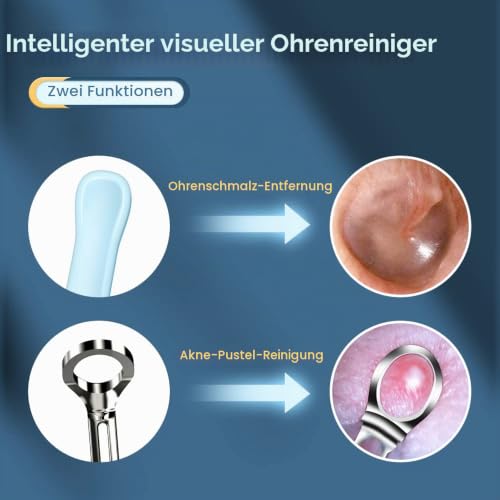 TOUCHBeauty Ear Wax Remover Otoscope, 1080P HD WiFi Ear Cleaner with Camera and 6 LEDs, IP67 Waterproof Ear Camera, USB Rechargeable for iPhone, iPad, Android, Children & Pets