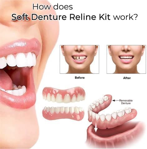 [Australia - AusPower] - Denture Silicone Reline Kit, Greatfit Denture Silicone Reline Kit, Soft Denture Reline Kit, Soft Denture Reline Kit for Men and Women (2pcs) 