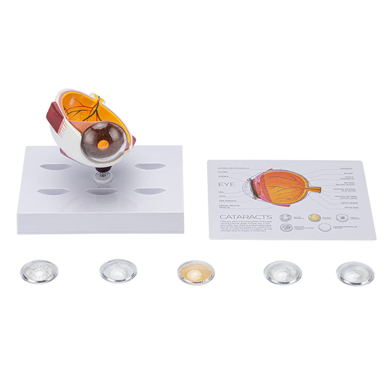 Cornea Eyeball Model Human Eye Model Human Eye Demonstration Teaching Prop Cataract Anatomy Medical Teaching Model