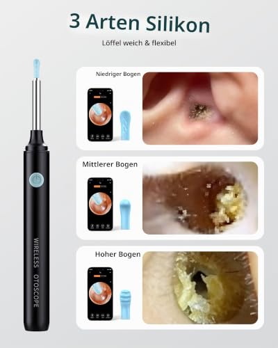Qimic Visual Ear Cleaner with Camera, 1080P HD WiFi Cleaning Tool, 3.5 mm Lens, 360° Wide Angle, IP67 Waterproof, 6 LEDs, USB-C Charging, Compatible with iOS & Android - Black