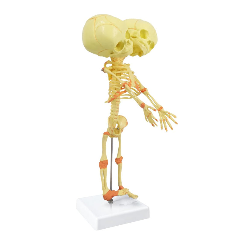EVOTECH SCIENTIFIC Human Infant Skeleton Model, Twin-Skull, Human Fetus Skeleton W/Double-Skull Model for Medical Study Teaching Display