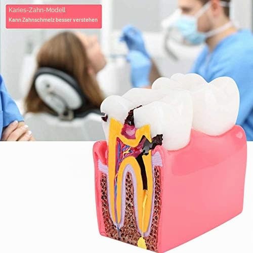 Dental Anatomy Model Resin Dental Lab Oral Care Model