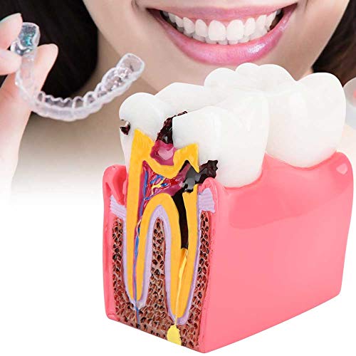 Dental Anatomy Model Resin Dental Lab Oral Care Model