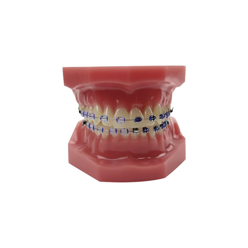 Orthodontic Tooth Model with Brackets, YOUYA DENTAL Demonstration Orthodontic Model for Education, Teeth Demonstration Typodonte Anatomical Teaching Tool with Metal and Ceramic Holder