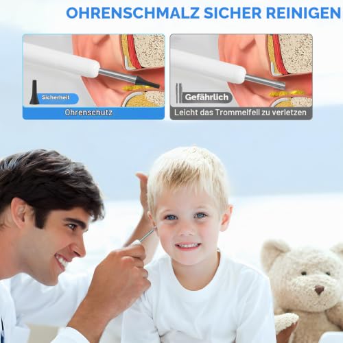 Ear Cleaner Camera, 4.3 Inch 1080p HD Professional Ear Wax Remover Otoscope with 6 LED Endoscope, 3.5 mm Ear Camera with 64G Children's and Adult Card, Plug and Play