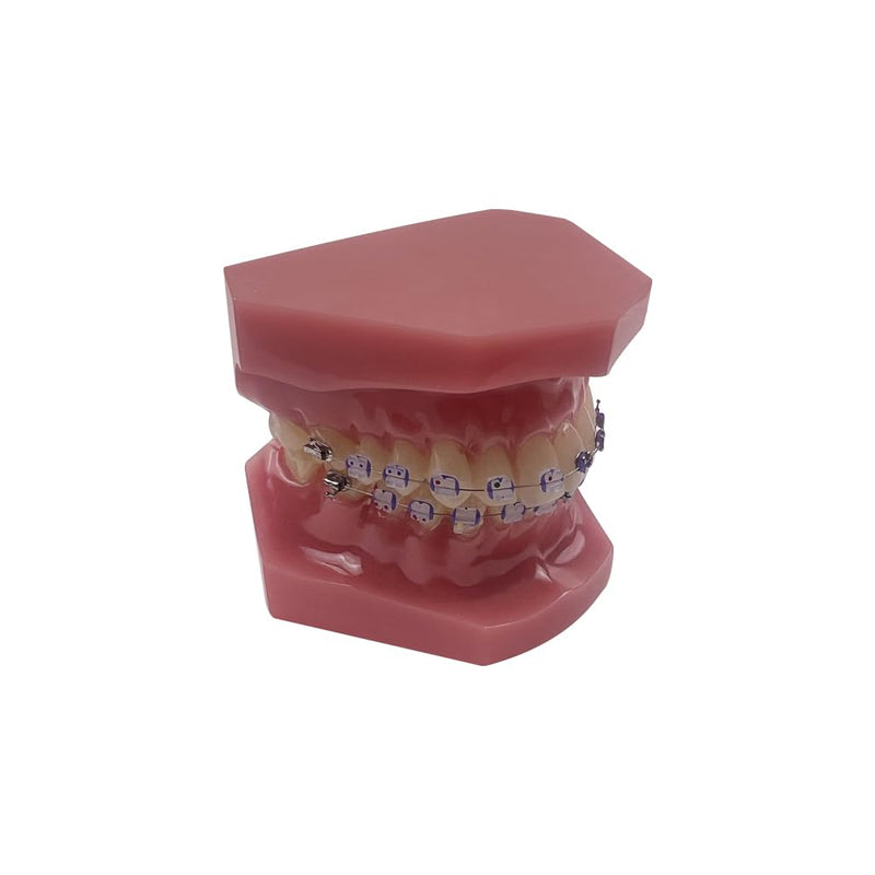 Orthodontic Tooth Model with Brackets, YOUYA DENTAL Demonstration Orthodontic Model for Education, Teeth Demonstration Typodonte Anatomical Teaching Tool with Metal and Ceramic Holder