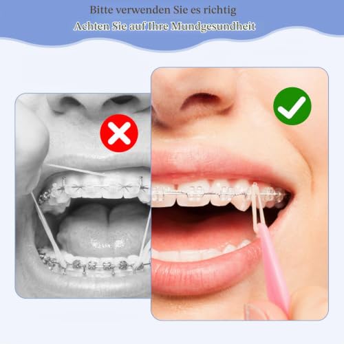 Pack of 500 Orthodontic Elastic Braces Rubber, Orthodontic Latex Elastics, with 5 Pieces Placements, Suitable for Braces, Gaps and Crooked Teeth (Fox 1/4 Inch)