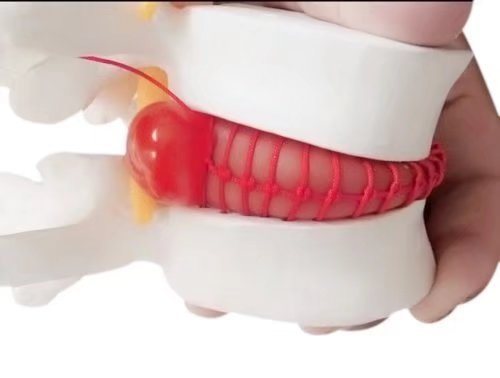 BoNew 1:1.5 Anatomical Human Lumbar Vertebrae Degenerative Lumbar Human Spine Model White Color