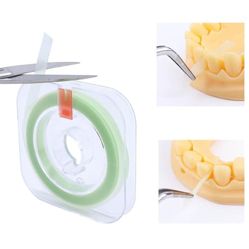 Pack of 4 tooth polishing strips, tooth sandpaper, stone remover for spaces