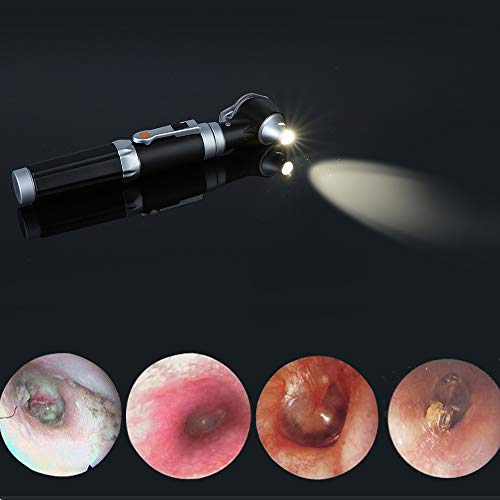 Mini Otoscope Magnification Diagnostic Otoscope with LED Light Direct Light Instrument for Healthy Ears for Doctors, Nurses, Adults, Kids, Babies, Elderly Pets, Animals black