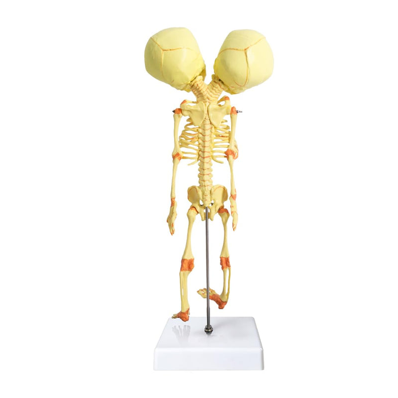 EVOTECH SCIENTIFIC Human Infant Skeleton Model, Twin-Skull, Human Fetus Skeleton W/Double-Skull Model for Medical Study Teaching Display