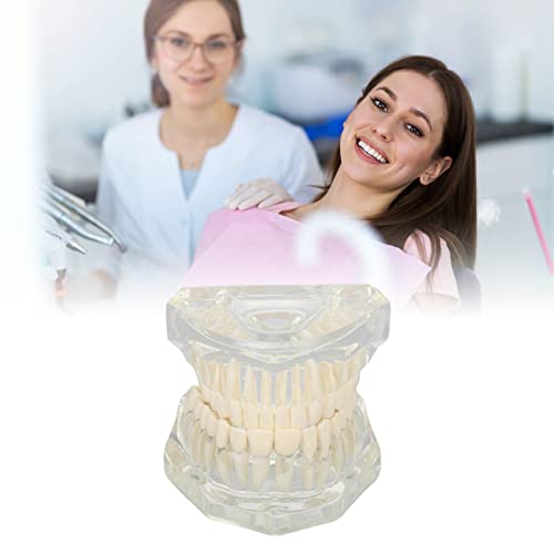 Dental Oral Typodont, Learning Tooth Model with Clear Structure, Standard Dental Dental Model, Dental Model Compatible with Dentists, Teachers and Students