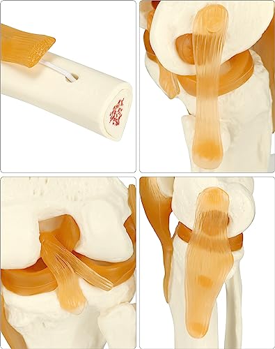 QWORK Life-Size Human Knee Joint Model Skeleton Anatomy for Medical Learning and Teaching (30.5 cm Height)