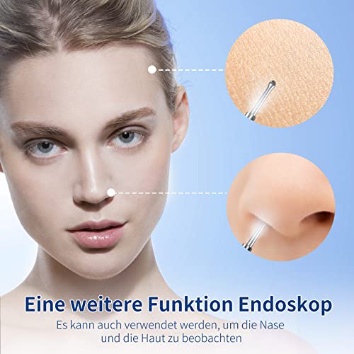 Ear Wax Remover, 1296P HD Otoscope, Ear Cleaner with Camera | 3.5 mm otoscope, IP67 waterproof, earvision app, 8 silicone attachments, compatible with Android smartphones