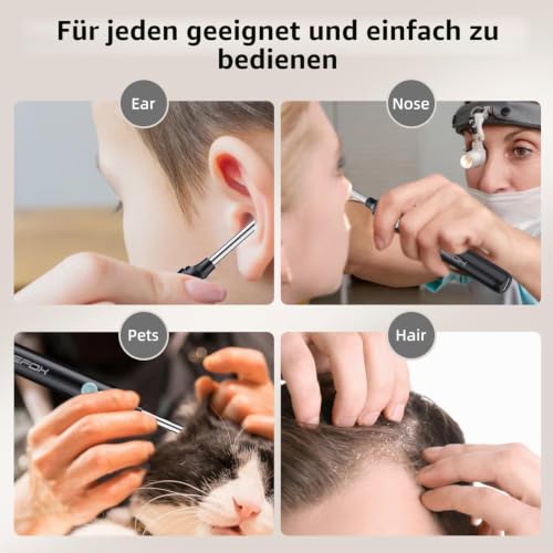Ear Wax Remover, Ear Cleaner, 1080P HD WiFi Ear Cleaner with Camera and 6 LEDs Lights, Ear Cleaning for Baby, Children, Adults (Matte Black) | 1080P HD-Kamera, 6-Achsen-Gyroskop und WiFi-Verbindung für präzise Sicht. Ohrenschmalz Entferner mit 6 LED-Li...