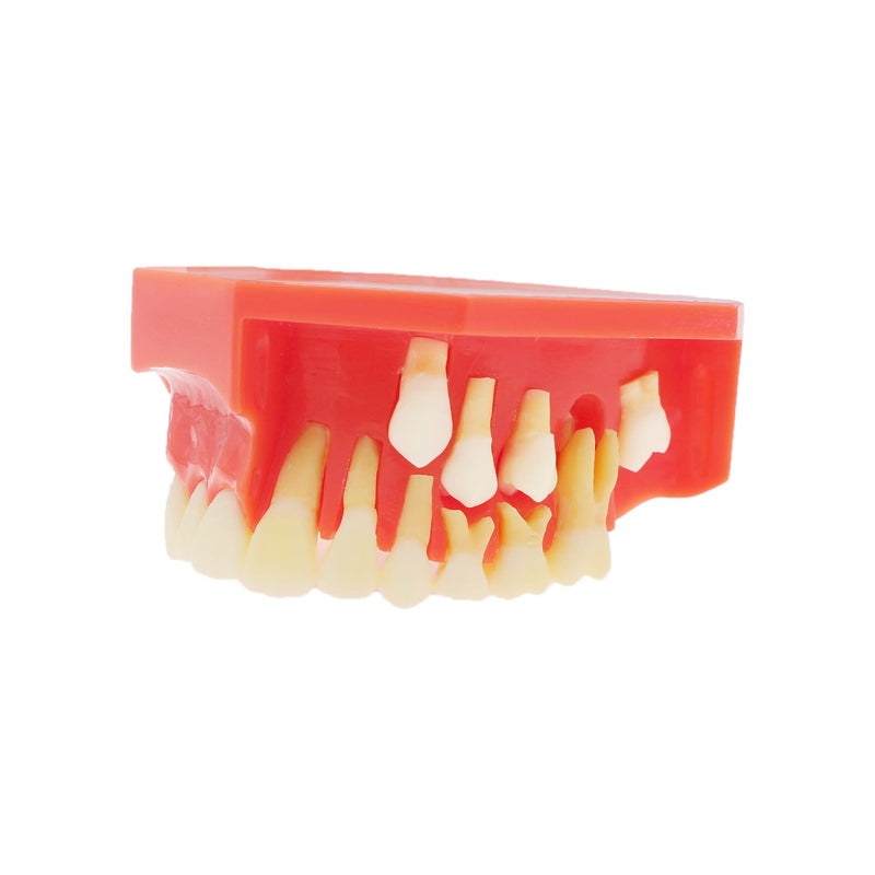 [Australia - AusPower] - Teeth Typodonts Dental Model #7013 - Teeth Eruption Development Model Alternating Model of Constant Pressure of Deciduous Teeth 