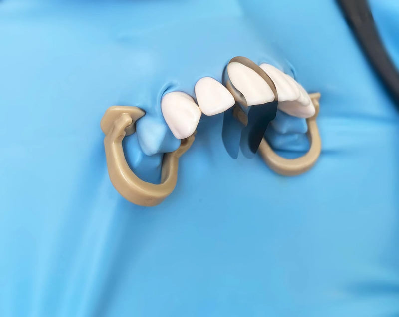 [Australia - AusPower] - 30Pcs/Box Anterior Matrix Bands, Dental Metal Curvature Matrix Bands for Proximal Anterior Restoration Thickness 30?m 