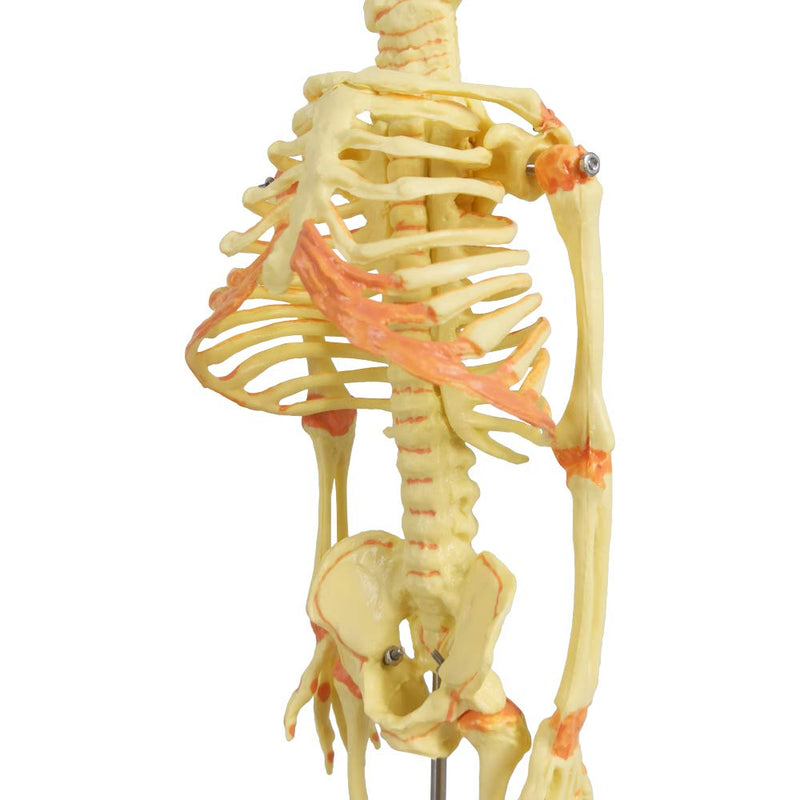 EVOTECH SCIENTIFIC Human Infant Skeleton Model, Twin-Skull, Human Fetus Skeleton W/Double-Skull Model for Medical Study Teaching Display