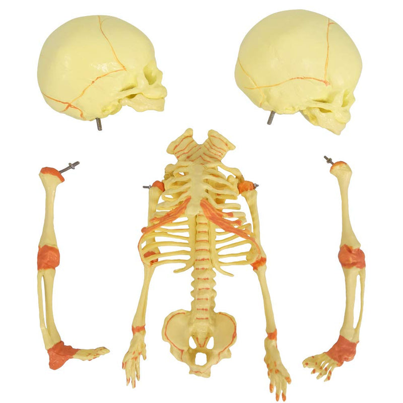 EVOTECH SCIENTIFIC Human Infant Skeleton Model, Twin-Skull, Human Fetus Skeleton W/Double-Skull Model for Medical Study Teaching Display