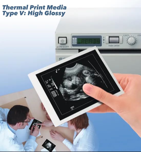 [Australia - AusPower] - UPP-110HG Ultrasound Paper Compatible for Sony, 2 Roll High Gloss Ultrasound Thermal Print Film/Media 110mm x 18m 