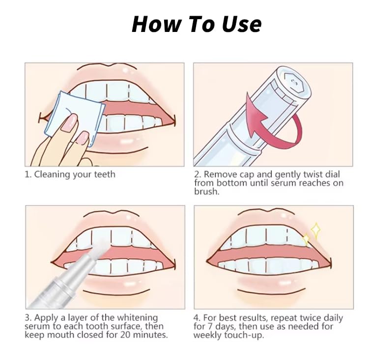 [Australia - AusPower] - NomadNest Teeth Whitening Pen (4 Pcs) - Painless Teeth Whitener, No Sensitivity, Mint Flavor, Travel-Friendly 
