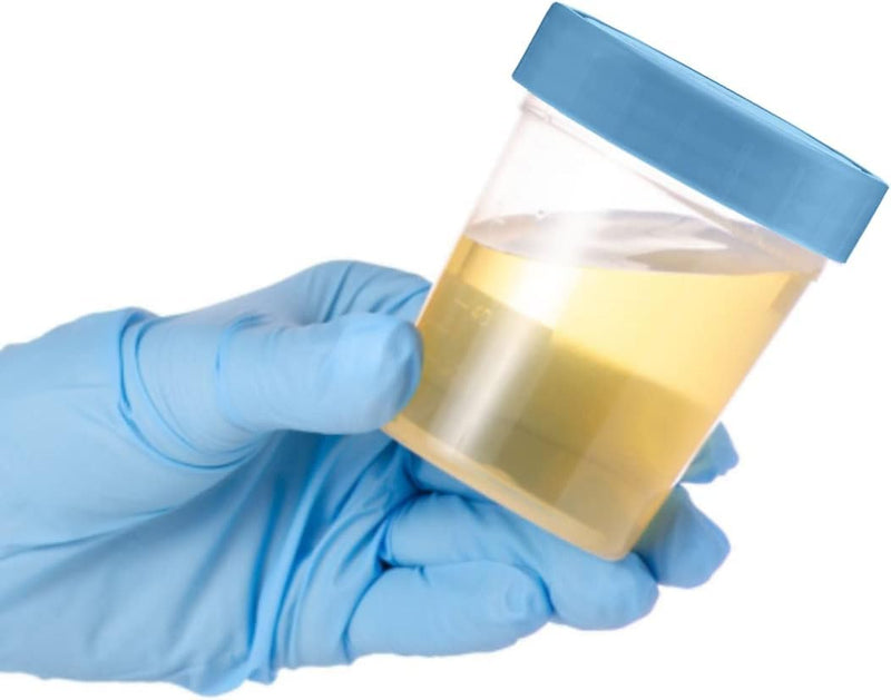 [Australia - AusPower] - Specimen Cups with Leak Proof Screw on Lids - 4oz Clear Non-Sterile Urine Sample Jars - Containers for Safe Pee, Stool, Semen Sample Collection for Testing (10) 10 