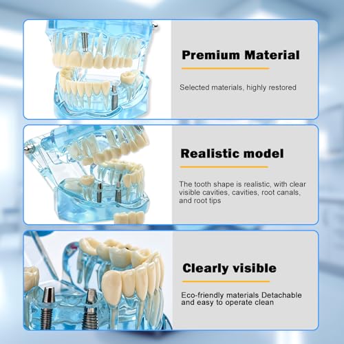 Dental Model with Removable Teeth, Dental Model, Transparent Model for Diseased Teeth, Transparent Tooth Model for Education, Clinic and Patient Demonstration, Blue