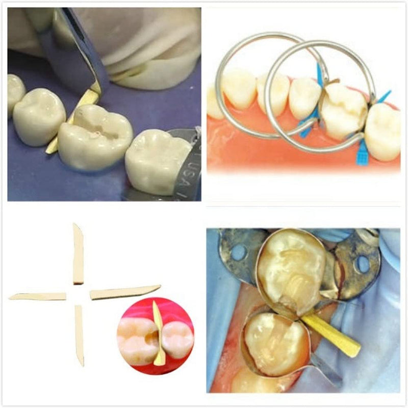 [Australia - AusPower] - Wooden Wedges Dental, Teeth Interproximal Wedges Disposable Fixing Materials for Dental Restoration, Impregnated with Hemostatic Composition Dental Set 200pcs 
