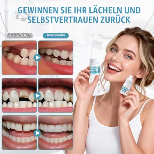 Dental cement self-hardening durable, fast curing | Dental adhesive for crowns, dentures glue, solution for crowns, bridges, dental caries and lost fillings