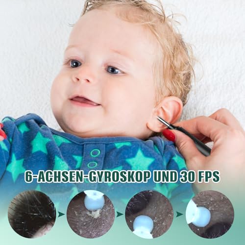 Earwax Remover Otoscope, LMECHN 1080P Ear Cleaner with 6 LEDs, Wifi Ear Cleaner with 6-Axis Gyroscope, IP67 Waterproof Ear Cleaning for iPhone, Android, iPad, Black