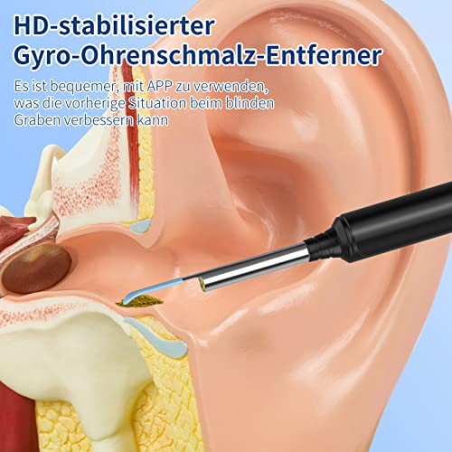 Ear Wax Remover, 1296P HD Otoscope, Ear Cleaner with Camera | 3.5 mm otoscope, IP67 waterproof, earvision app, 8 silicone attachments, compatible with Android smartphones