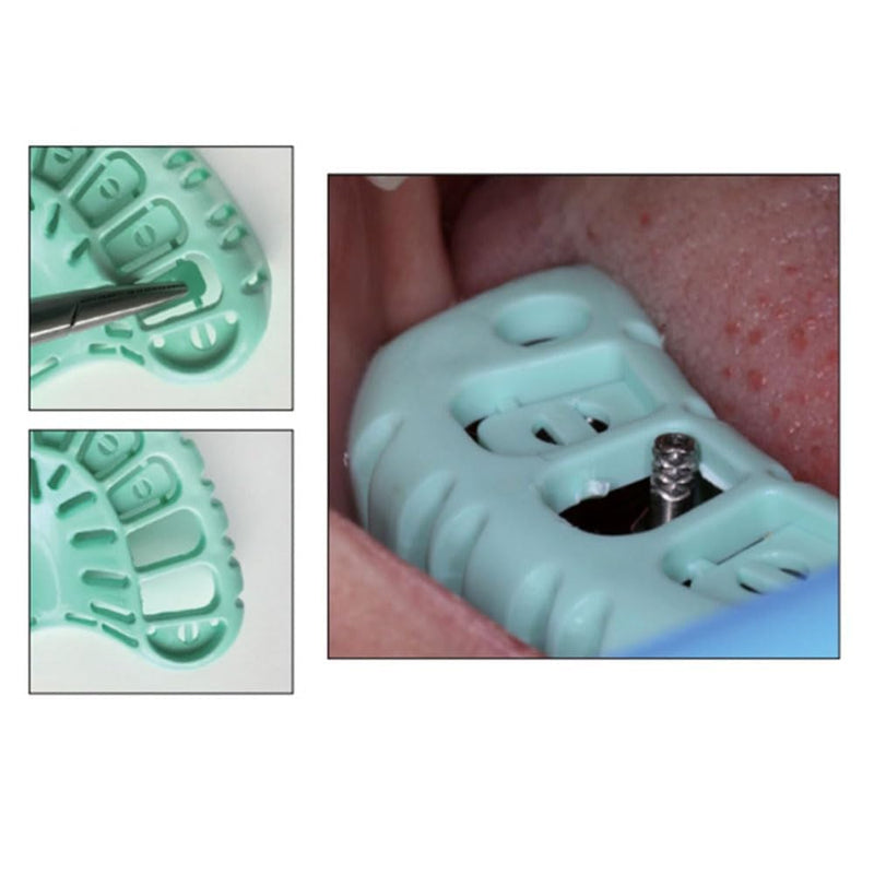 [Australia - AusPower] - Dental Impression Trays Disposable Dental Implant Trays Plastic Green Full Mouth Autoclavable Perforated Impression Trays Set Mold Tray 3 Pairs (LS-Mix 3pairs) LS-MIX 3pairs 
