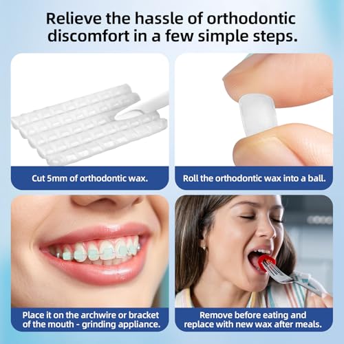 RAZOKO Braces Wax - Pre Cut Strong Adhesion Toothwax 750 Pieces Food Grade Comfortable Protection for Kids & Adults Portable Travel Case Fragrance Free White fragrance-free 750 Stücke