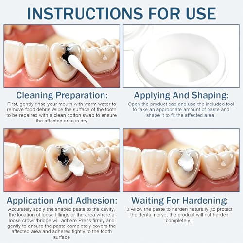 Temporary Dental Filling Material, Tooth Repair and Pain Relief, Self-Hardening Temporary Teeth Filling, Ensure Emergency Care for Teeth, Easy to Use, 15g