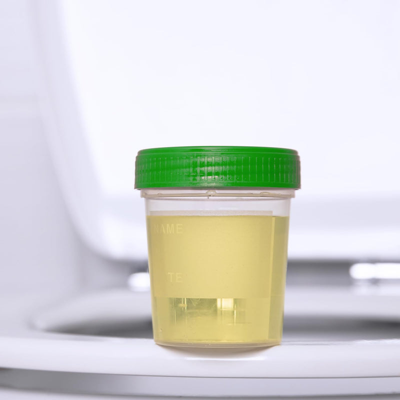 10 Urine Cups with Screw Lid, Sample Cup, Sample Container, Leak-Proof, Capacity 125 ml, Storage Cup, Graduated 20 ml to 100 ml, Polypropylene (PP), Sample Collection Container 10