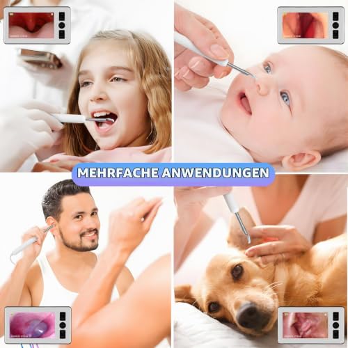 Ear Cleaner Camera, 4.3 Inch 1080p HD Professional Ear Wax Remover Otoscope with 6 LED Endoscope, 3.5 mm Ear Camera with 64G Children's and Adult Card, Plug and Play
